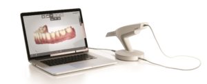 TRIOS 3D scanner