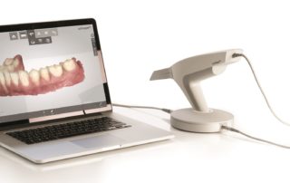 TRIOS 3D scanner