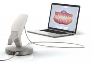 TRIOS 3D scanner
