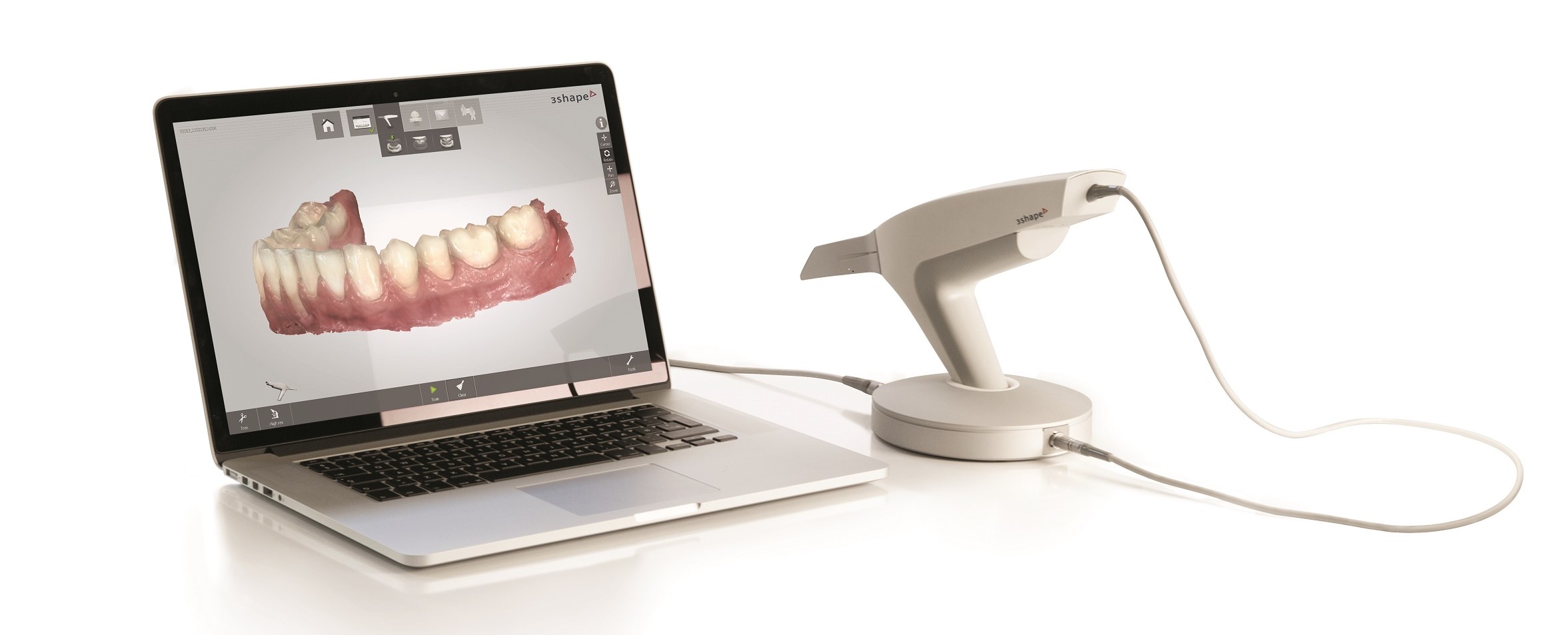 TRIOS 3D scanner