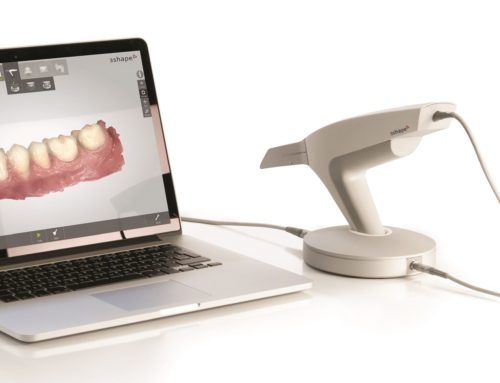 Our New Technology: Trios 3Shape Digital Scanner