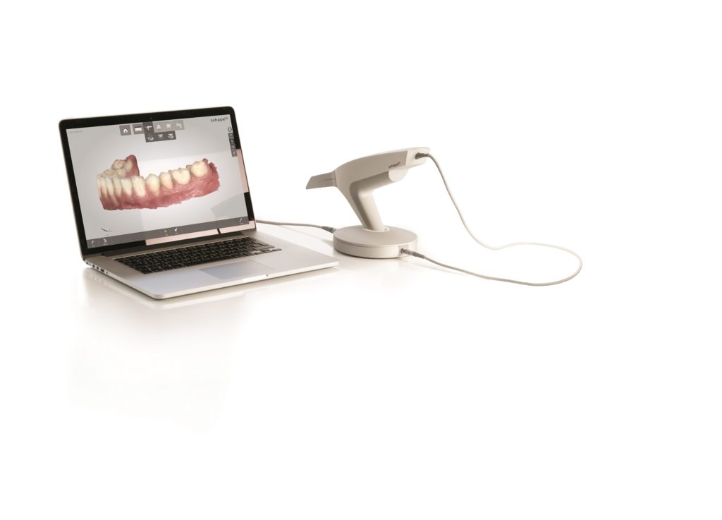 TRIOS scanner Mill Creek Dental Dr. Nikki Chin, Dentist in Mill